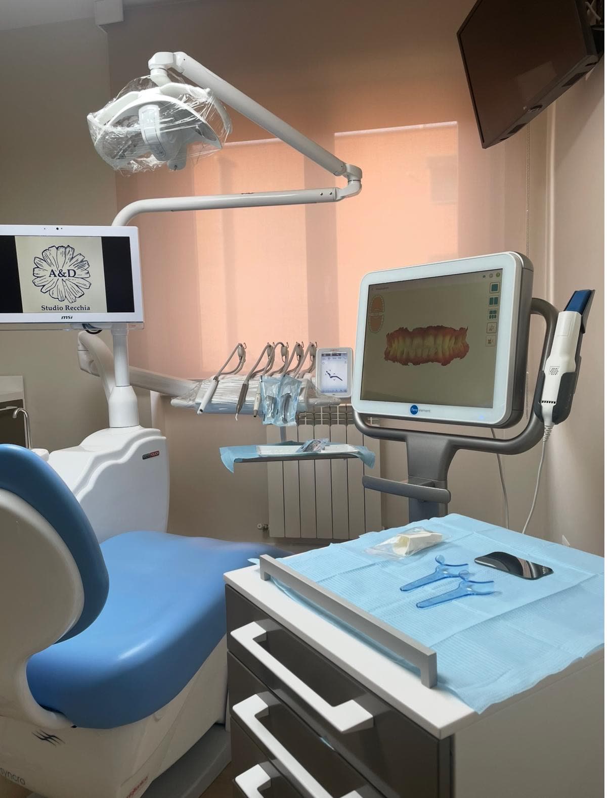 La poltrona e lo scanner intraorale